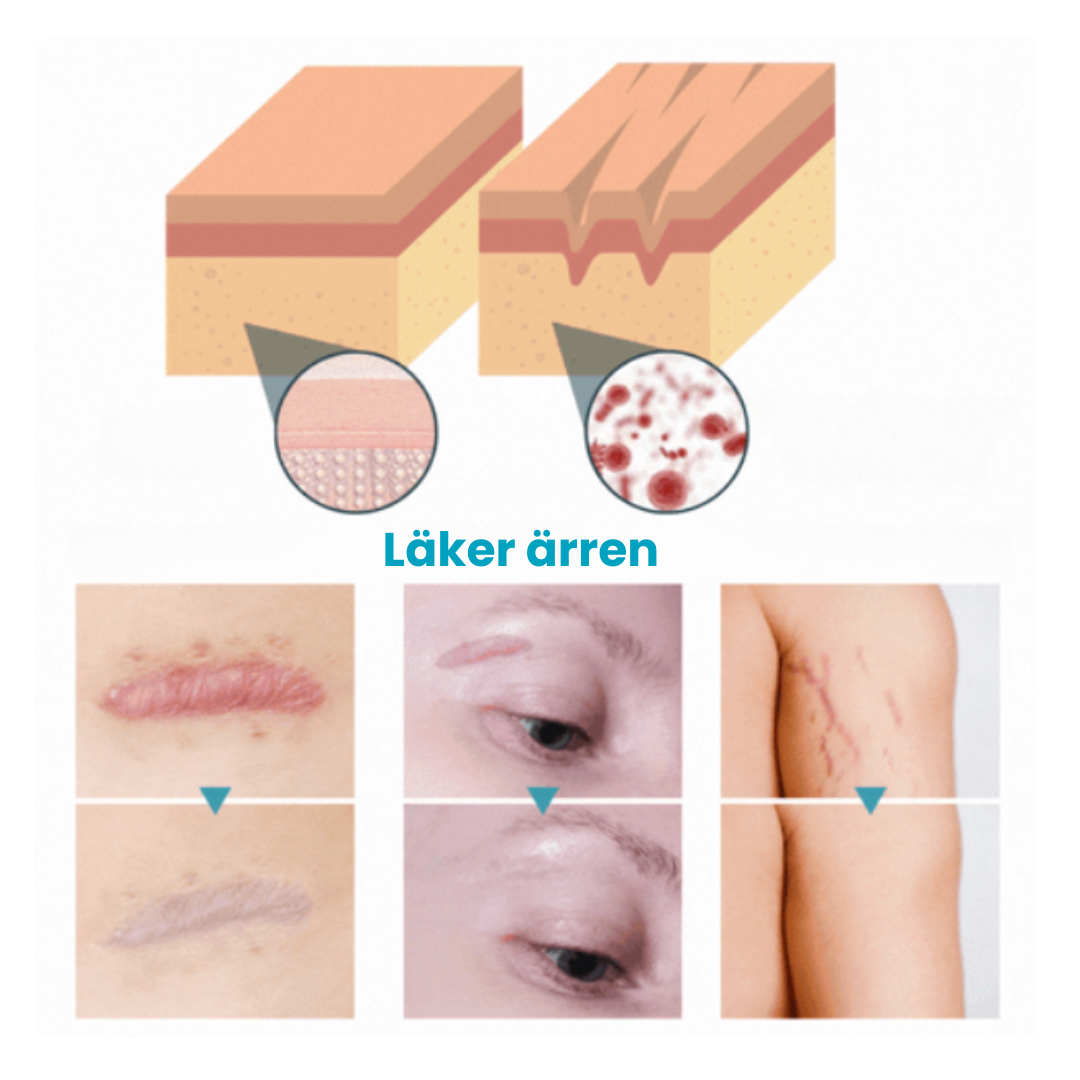 SkinRenew™ Silikonplåster