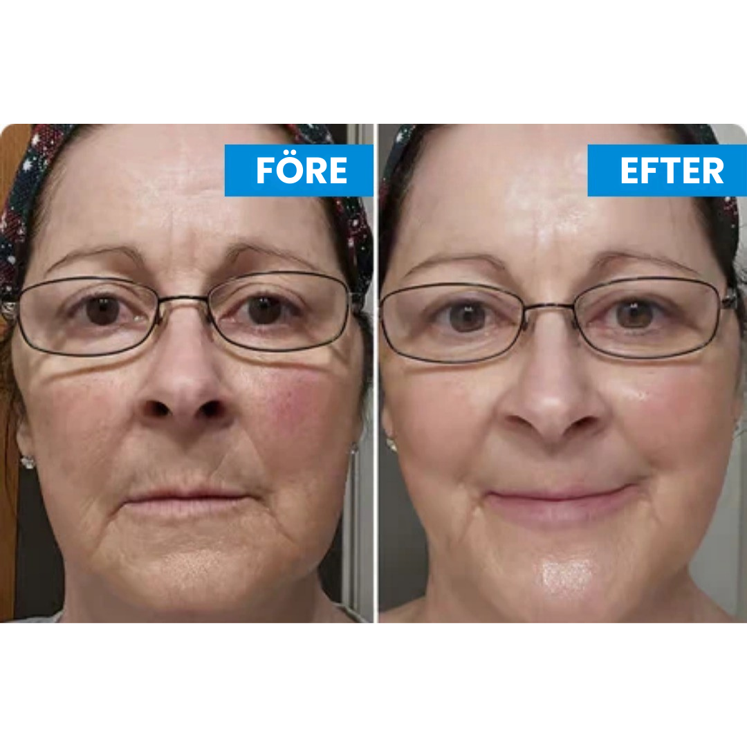 SlimLift™ Korean-Beauty