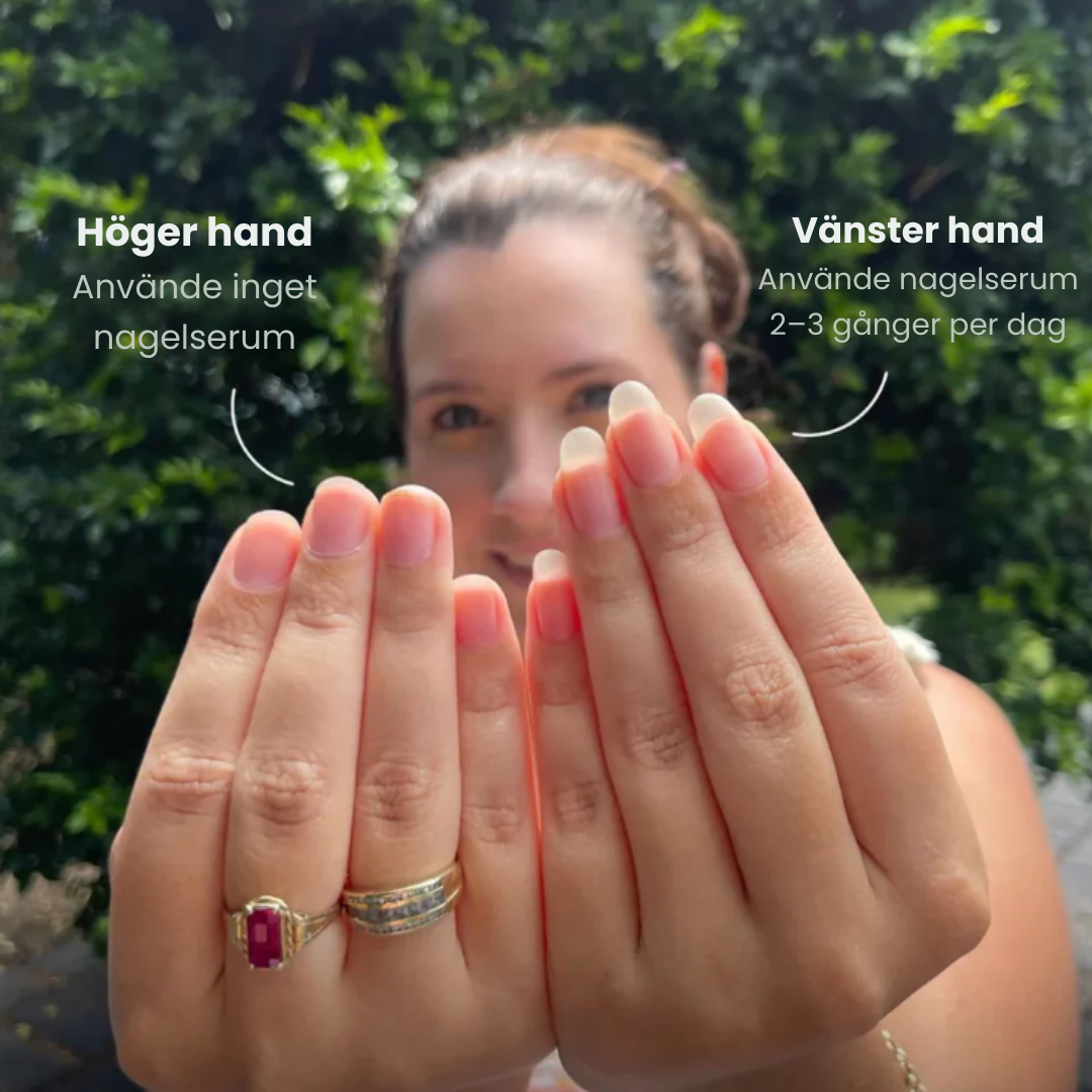 NailBloom™