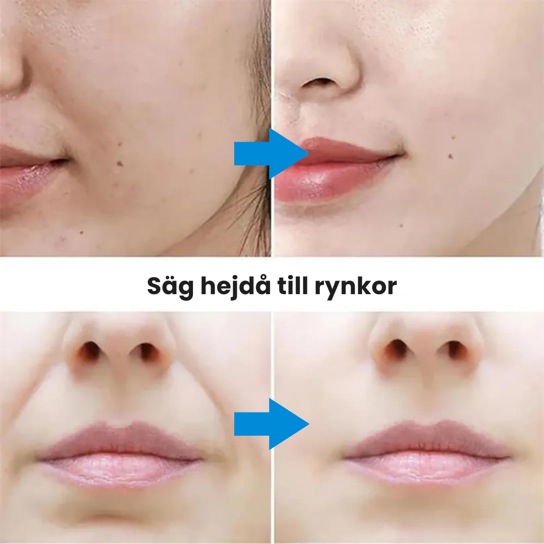SlimLift™ Korean-Beauty