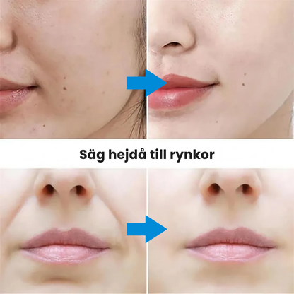 SlimLift™ Korean-Beauty