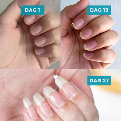 NailBloom™