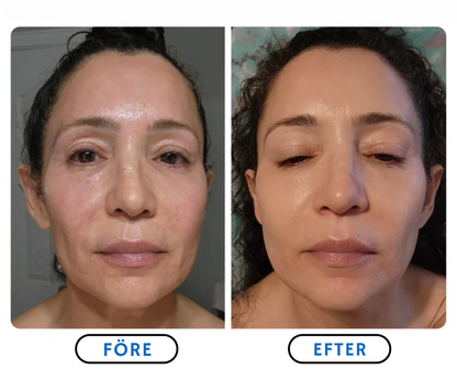 SlimLift™ Korean-Beauty
